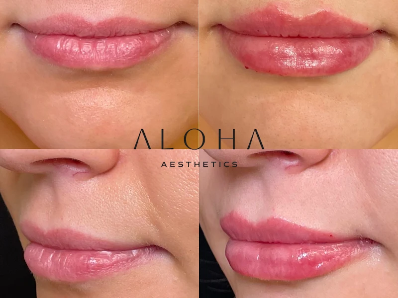 Aloha Aesthetics FL