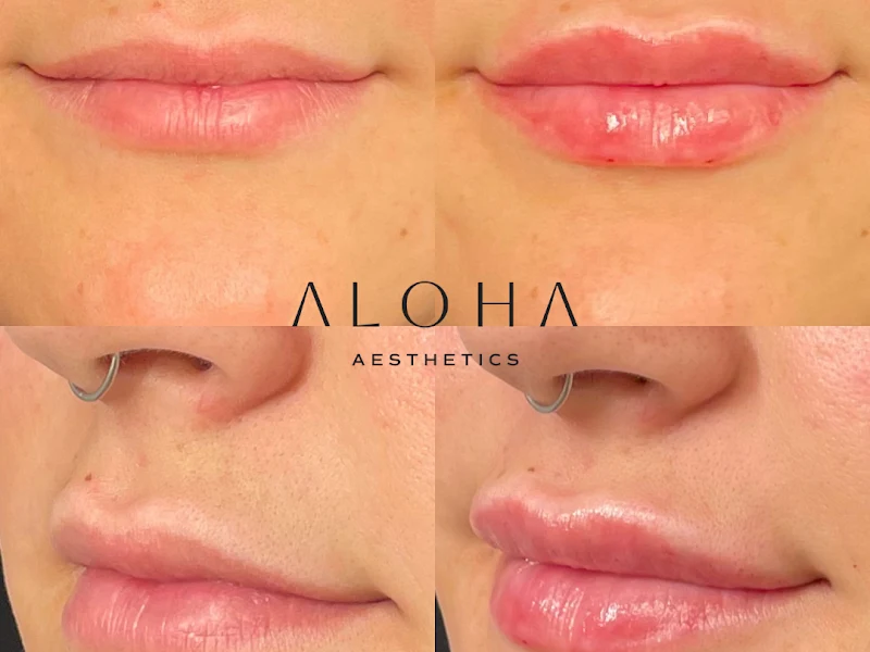 Aloha Aesthetics FL