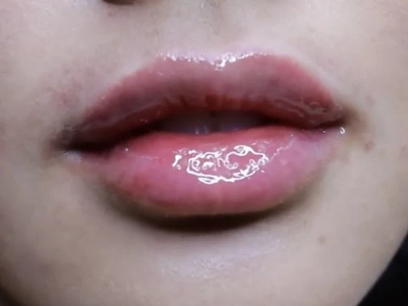 Enhance Biomed Aesthetics