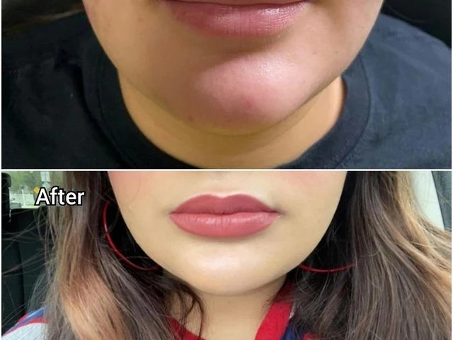Enhance Biomed Aesthetics