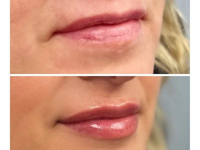 Pure Elements Medical Spa LLC