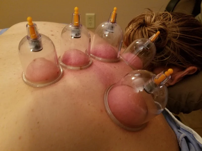 Jacksonville Chiropractic & Acupuncture